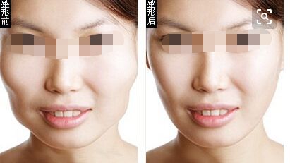 長沙疤痕治療哪家醫(yī)院靠譜 長沙疤痕治療哪家醫(yī)院靠譜