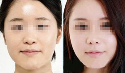 優(yōu)質(zhì)修復妊娠紋服務中心推薦 優(yōu)質(zhì)修復妊娠紋服務中心推薦