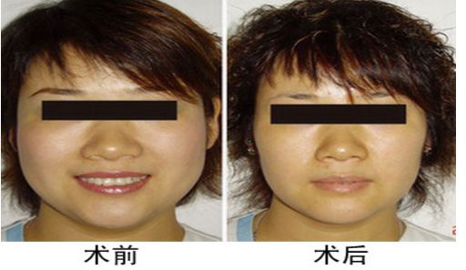 北京祛斑醫(yī)院三甲排行榜：北京哪家祛斑醫(yī)院好？