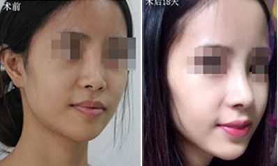 晟顏整形醫(yī)院評價及口碑如何？