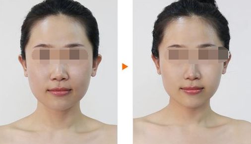 廣州哪家整形醫(yī)院好？排名前十值得推薦