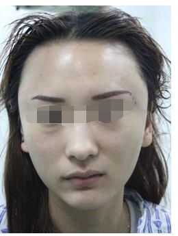 浙江地區(qū)有哪些知名鼻部整形私立醫(yī)院？