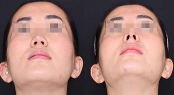 蘭州經(jīng)驗豐富的脂肪豐胸醫(yī)生推薦：逯巖、郭曉磊、雷蓓