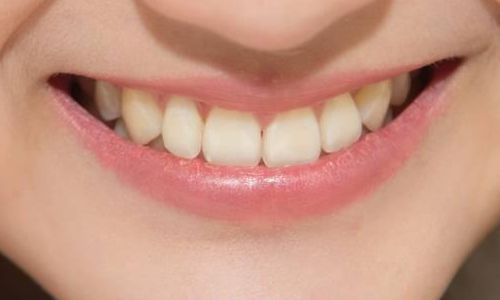 韓國腰腹環(huán)吸哪里好？必當(dāng)歸、Qline、夢想吸脂瘦腰腹推薦