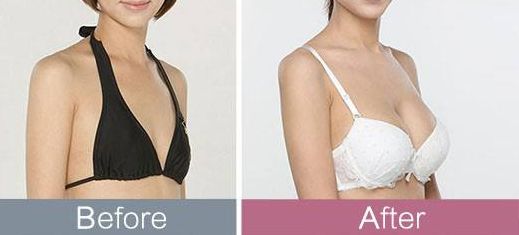 東莞哪家整形醫(yī)院頗受推薦？