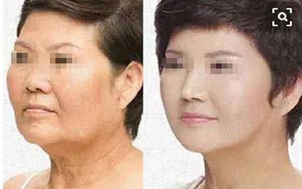 揭秘鄭州鼻修復(fù)名家，一覽權(quán)威醫(yī)生陣容