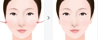 雙眼皮修復(fù)醫(yī)院十強(qiáng)排行榜指南:為你的完美眼眸保駕護(hù)航 雙眼皮修復(fù)醫(yī)院十強(qiáng)排行榜指南:為你的完美眼眸保駕護(hù)航
