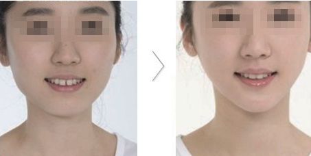 哪家醫(yī)院在北京具有卓越的醫(yī)美科技和服務(wù)？歐洲醫(yī)學(xué)中心、北京協(xié)和、北大人民醫(yī)院等公立單位有何特色？