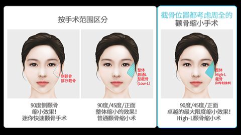 成都康橋眼科醫(yī)院美容科的評(píng)價(jià)及價(jià)格費(fèi)用推薦 成都康橋眼科醫(yī)院美容科的評(píng)價(jià)及價(jià)格費(fèi)用推薦