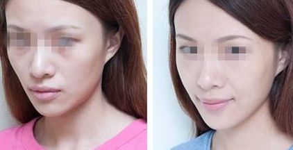 杭州治療耳矯正的專業(yè)醫(yī)院排行榜 杭州治療耳矯正的專業(yè)醫(yī)院排行榜