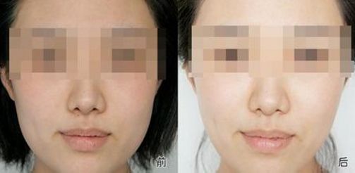 日照市前十一家信譽(yù)較高的整形美容醫(yī)院排行 日照市前十一家信譽(yù)較高的整形美容醫(yī)院排行