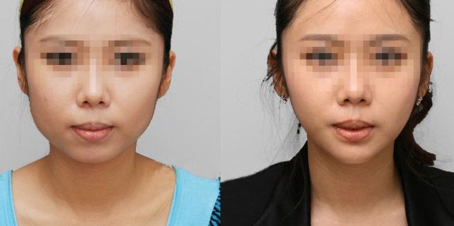 蘭州哪家整形醫(yī)院口碑好？看看排名榜單！
