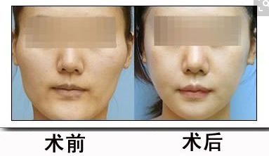 北京醫(yī)院2024年磨骨治療醫(yī)院盤點 北京醫(yī)院2024年磨骨治療醫(yī)院盤點