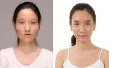 2024年臺(tái)州地區(qū)優(yōu)秀整形醫(yī)院推薦 2024年臺(tái)州地區(qū)優(yōu)秀整形醫(yī)院推薦