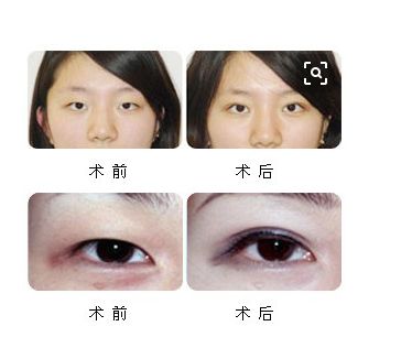 2024蘭州市熱門(mén)整容醫(yī)院排名前十