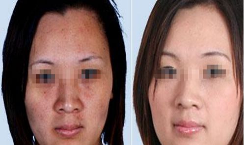 3家值得信賴的廣州整形醫(yī)院推薦 3家值得信賴的廣州整形醫(yī)院推薦