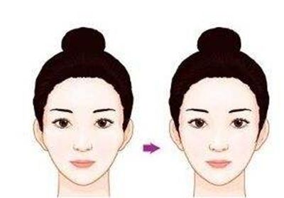 深圳哪家醫(yī)院的隆鼻效果好？醫(yī)生口碑怎么樣？