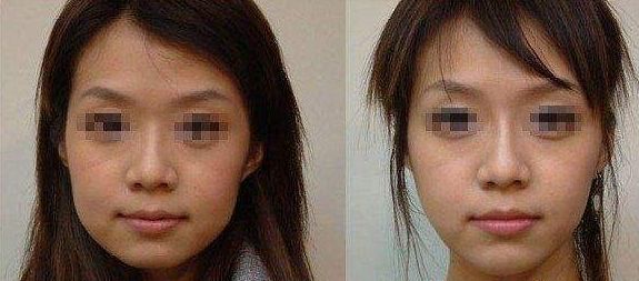 沈陽哪家整形醫(yī)院好評排行榜 沈陽哪家整形醫(yī)院好評排行榜