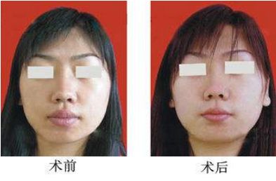 杭州哪家整形醫(yī)院口碑比較好，推薦浙江醫(yī)美排行榜前十佳