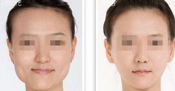 黑龍江三甲整形醫(yī)院熱門榜單，前三強大揭秘！