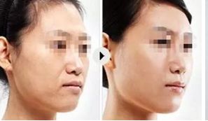 上海頂尖美容整形醫(yī)院精選，讓你真正了解排行榜