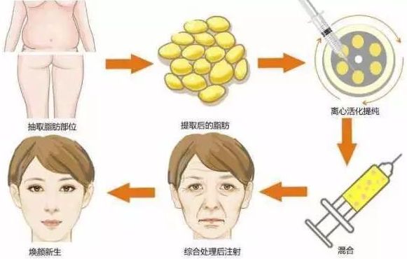 臺州哪家整形美容醫(yī)院效果好？