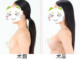 鄭州治療眼袋技術(shù)哪家好 鄭州治療眼袋技術(shù)哪家好
