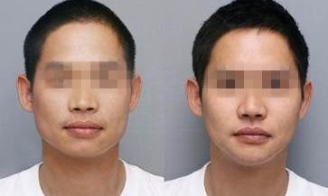 上海市做雙眼皮排名前列的醫(yī)院是哪家 上海市做雙眼皮排名前列的醫(yī)院是哪家