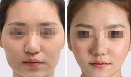 武漢熙蒙整形醫(yī)院信譽(yù)如何醫(yī)生介紹、費(fèi)用更新了！