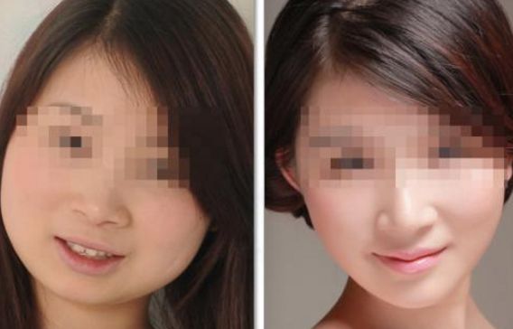 洛陽哪家醫(yī)學美容院眉部整形技術頂尖 洛陽哪家醫(yī)學美容院眉部整形技術頂尖