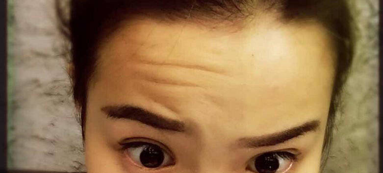 深圳哪幾家醫(yī)美整形醫(yī)院口碑最好？