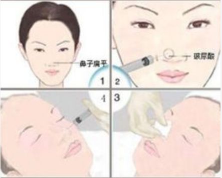 邯鄲維多利亞美容醫(yī)院體驗(yàn)全解析:門(mén)診介紹及價(jià)格指南 邯鄲維多利亞美容醫(yī)院體驗(yàn)全解析:門(mén)診介紹及價(jià)格指南