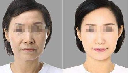 梅州皮膚科醫(yī)院排名前五名匯總 梅州皮膚科醫(yī)院排名前五名匯總