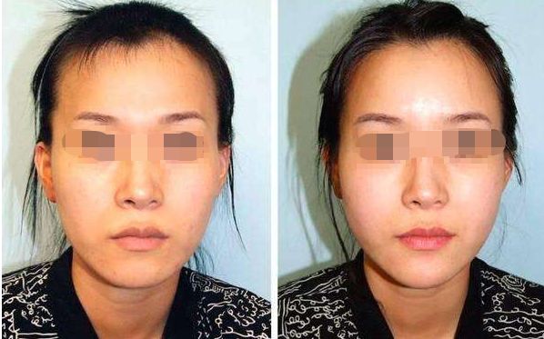 汕頭哪家雙眼皮整形醫(yī)院口碑好 汕頭哪家雙眼皮整形醫(yī)院口碑好