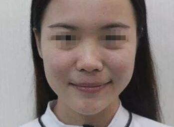 南充疤痕整形醫(yī)院排名精選，助你尋找完美去疤痕之旅