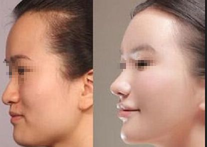 臨沂市醫(yī)美醫(yī)院排名及推薦，推薦你去哪家治療效果好
