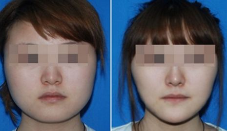 重慶普瑞眼科醫(yī)院怎么坐地鐵到 重慶普瑞眼科醫(yī)院怎么坐地鐵到