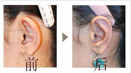 成都友誼醫(yī)院疤痕科：設(shè)備先進(jìn)、技術(shù)精湛，治療效果如何？