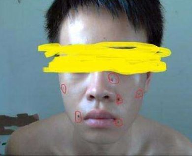 ?？谑笳吾t(yī)院匯總，哪家效果比較好？