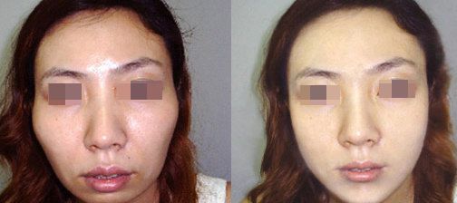 廣州五家口碑俱佳的整形醫(yī)院怎么選 廣州五家口碑俱佳的整形醫(yī)院怎么選
