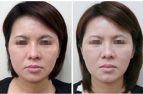 廣元整形美容醫(yī)院排行榜:口碑推薦+專業(yè)技術(shù) 廣元整形美容醫(yī)院排行榜:口碑推薦+專業(yè)技術(shù)