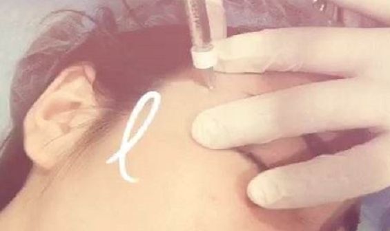 深圳前海地區(qū)哪家整形醫(yī)院比較靠譜？好的深圳整容醫(yī)院有哪些？