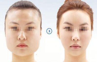 2024年溫州哪家醫(yī)院的整形美容效果最佳？