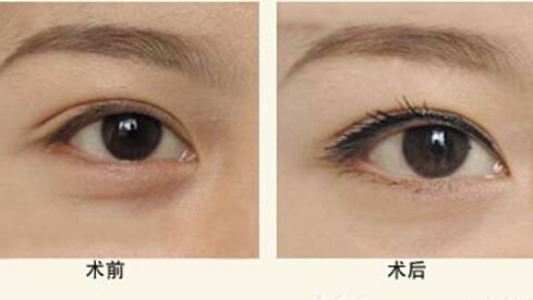 樂(lè)山人民醫(yī)院醫(yī)生特色項(xiàng)目與服務(wù)評(píng)價(jià)全解析 樂(lè)山人民醫(yī)院醫(yī)生特色項(xiàng)目與服務(wù)評(píng)價(jià)全解析