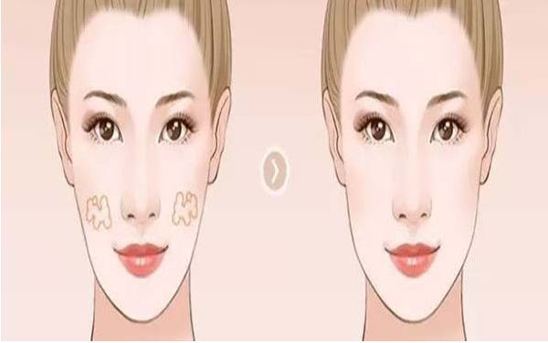 深圳福華整形醫(yī)院的評(píng)價(jià)怎么樣？