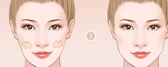 濟南整形醫(yī)院推薦:權威醫(yī)院排名及口碑比較 濟南整形醫(yī)院推薦:權威醫(yī)院排名及口碑比較