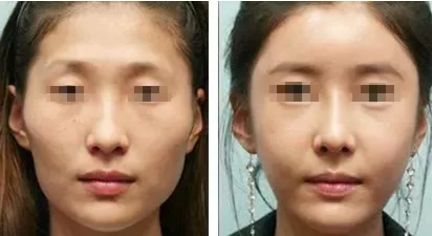 剖析米蘭柏羽皮膚科料金:熱門醫(yī)生推薦及項目價格一覽 剖析米蘭柏羽皮膚科料金:熱門醫(yī)生推薦及項目價格一覽