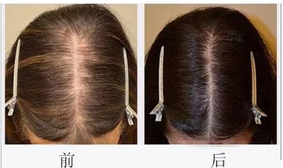 溫州粉范整形醫(yī)院坐診醫(yī)生團隊的技術和2023服務水準綜合解析 溫州粉范整形醫(yī)院坐診醫(yī)生團隊的技術和2023服務水準綜合解析