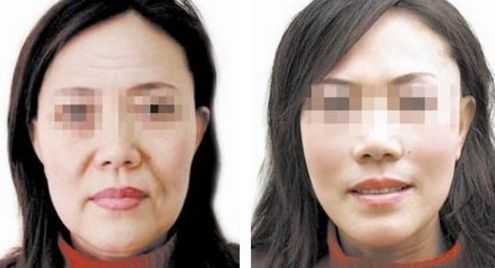 洛陽整容醫(yī)院排名與評價 洛陽整容醫(yī)院排名與評價