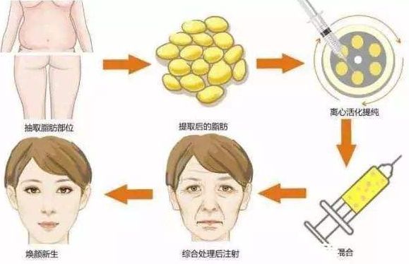2024德州更受歡迎的吸脂整形醫(yī)院大全：用戶評價匯總、口碑盤點
